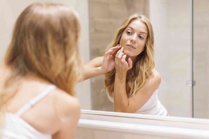 cremas faciales acne