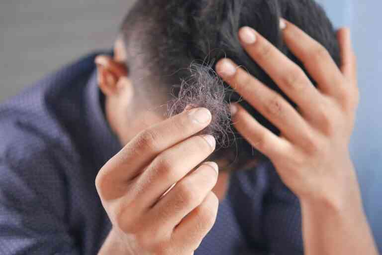 Alopecia difusa: una caída reversible que afecta tanto a hombres como a mujeres