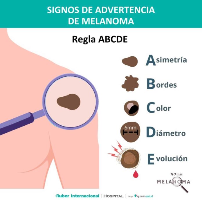 La dermatóloga Irati Allende explica qué es el callo solar y por qué es tan peligroso