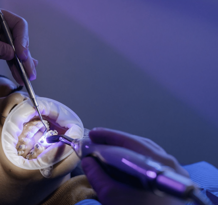 El Centre Dental Francesc Macià explica la importancia de una revisión dental después de las vacaciones de verano