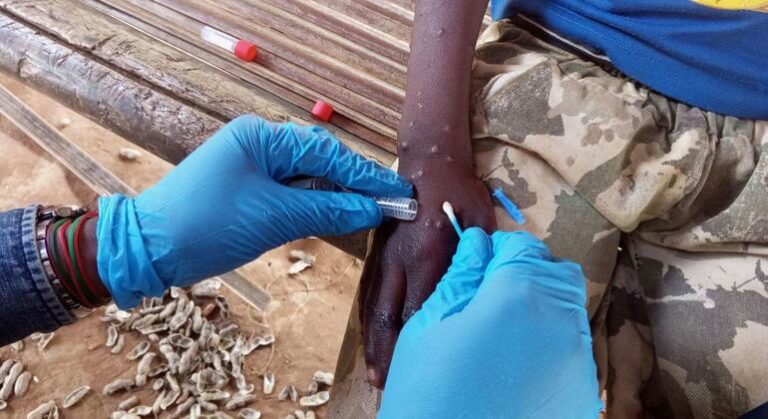 El rápido acceso a las pruebas de diagnóstico es fundamental para combatir el mpox