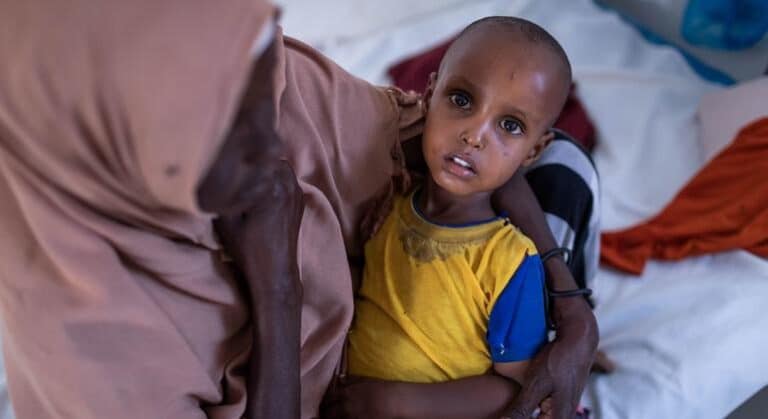 La emaciación infantil se puede prevenir con inversiones adecuadas