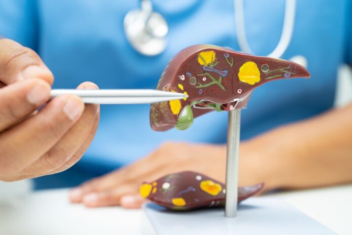 Dr. Alfredo Yoldi, endocrinólogo de Policlínica Gipuzkoa: Una nueva esperanza para el tratamiento del hígado graso