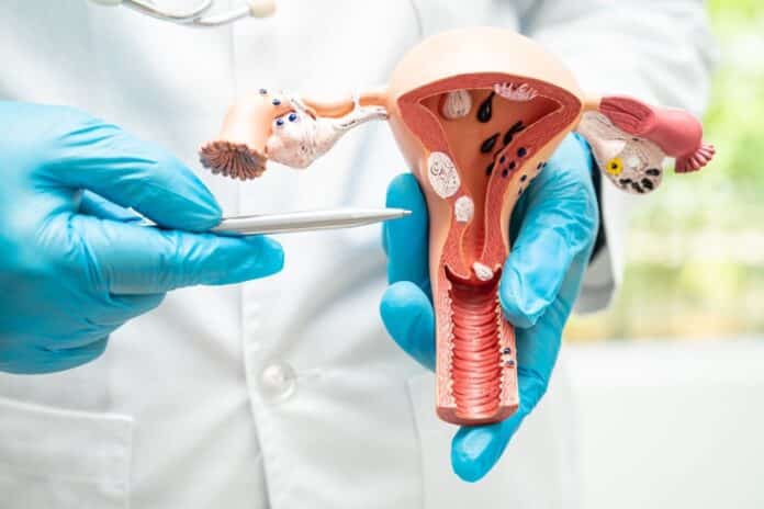 Dra. Blanca Fernández, ginecóloga de Policlínica Gipuzkoa: "Con una buena prevención y tratamiento del VPH, podemos prevenir el cáncer de cuello de útero"