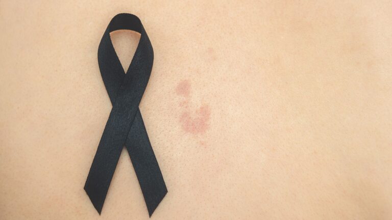 "Exponerse al sol sin protección puede tener consecuencias graves tanto a corto como a largo plazo", explica la dermatóloga Maribel Martínez