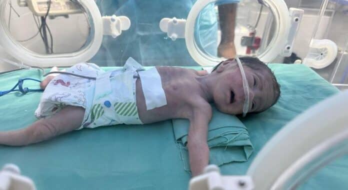 Hambruna en Gaza, migración hacia el sur, cambio climático... Las noticias del martes