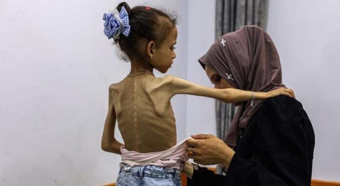 Gaza: cada vez hay más indicios de hambruna e inanición generalizada
