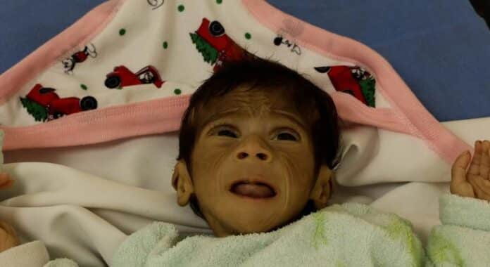 La OMS alerta sobre una "hambruna masiva" en Gaza