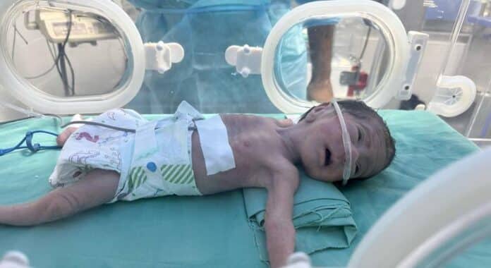 UNRWA: La hambruna masiva en Gaza es fabricada y deliberada