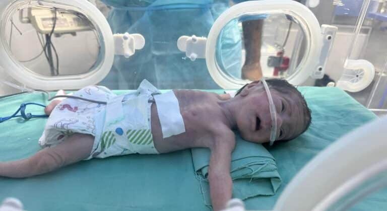 UNRWA: La hambruna masiva en Gaza es fabricada y deliberada