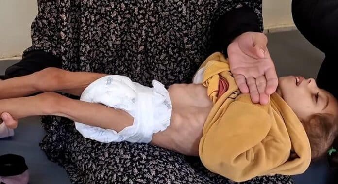Niños desnutridos en Gaza, mujeres en Afganistán, Myanmar... Las noticias del jueves