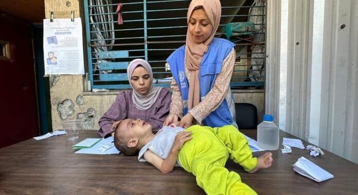 Uno de cada cinco niños en la ciudad de Gaza está gravemente desnutrido
