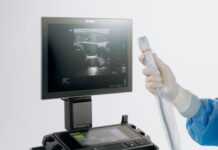 Sonosite LX: Revoluciona el POCUS con el Primer Transductor de 46 MHz Sonosite LX introduce la ultra-alta frecuencia en POCUS con el primer y único transductor de 46 MHz