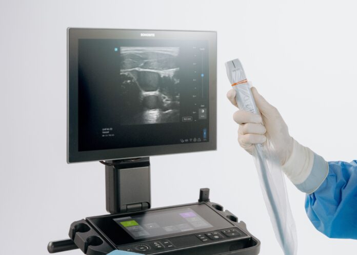 Sonosite LX: Revoluciona el POCUS con el Primer Transductor de Sonosite LX introduce la ultra-alta frecuencia en POCUS con el primer y único transductor de 46 MHz