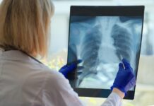 Dejar de Fumar: Clave para Frenar la EPOC Según el Dr. Aitor Asensi Dr. Aitor Asensi, neumológo de Policlínica Gipuzkoa: "Dejar de fumar es la medida más importante para frenar la evolución de la EPOC"