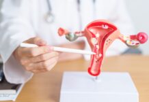 Endometriosis: Un Desafío Invisible que Afecta la Vida de Muchas Mujeres Dr. Juan Céspedes, ginecólogo de Policlínica Gipuzkoa: "La endometriosis deteriora la calidad de vida, es difícil de diagnosticar y muchas mujeres la ocultan por vergüenza o por creer que es normal"