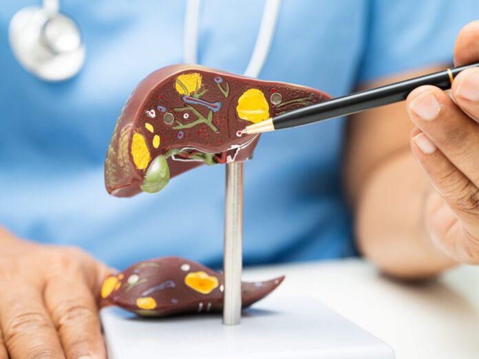 Dr. Juan Arenas, especialista en Aparato Digestivo de Policlínica Gipuzkoa: "La pérdida de peso es la clave para mejorar el hígado graso y el síndrome metabólico"