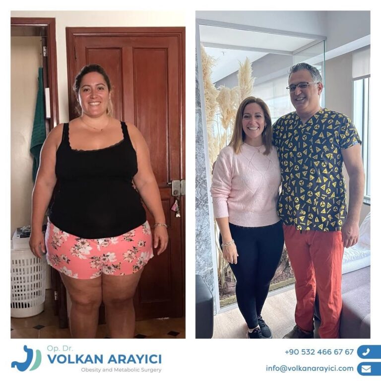 Manga Gastrica en Turquía: el Dr.Volkan Arayıcı ofrece consejos para elegir la clínica adecuada para cada paciente