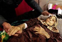 Pacientes con Cáncer en Gaza: Suplicando una Oportunidad de Vida “Nos estamos muriendo”: Pacientes con cáncer en Gaza suplican una salida