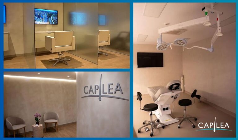 Capilea España: Un Año Devolviendo Confianza a Pacientes en Madrid