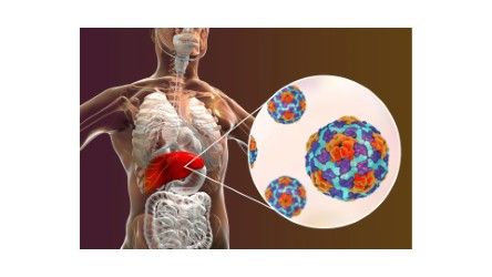 La Hepatitis Puede Pasar Desapercibida: Una Simple Prueba Permite Detectarla a Tiempo