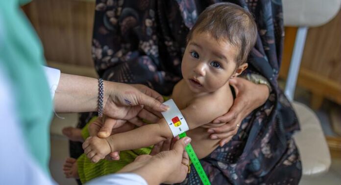 La Desnutrición Infantil Llega a Niveles Críticos en 12 Provincias La desnutrición infantil alcanza niveles críticos en 12 provincias de Afganistán