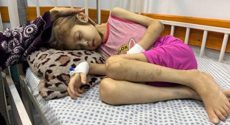 Tragedia Infantil: Más de 300 Niños Fallecidos en Gaza en 300 Días Tras el Anuncio del Alto el Fuego